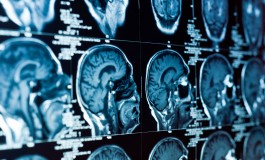 CorTechs Labs And Novartis Partner On Solutions for Quantifying Brain Volume In MS Patients