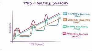 Types of MS graph-Thank-you to our member Jilly Verina - Living With MS