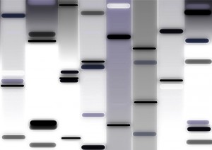 Inovio Pharmaceuticals MS DNA therapies