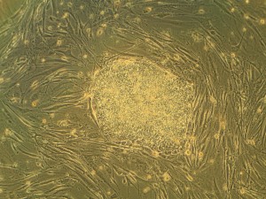 stem cells for mylenation