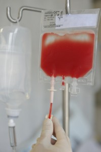Stem Cell Transplants for MS
