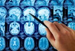A hand holding a pen points to a brain MRI scan among several rows of brain images displayed on a screen.