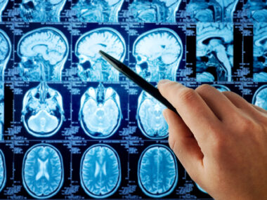 A hand holding a pen points to a brain MRI scan among several rows of brain images displayed on a screen.