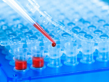 smoldering lesions and severe