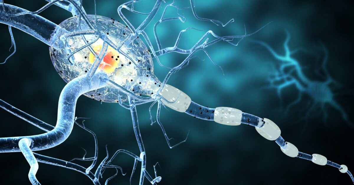 MS Active and Inactive Lesions Differ in Levels of Enzymes that Drive ...