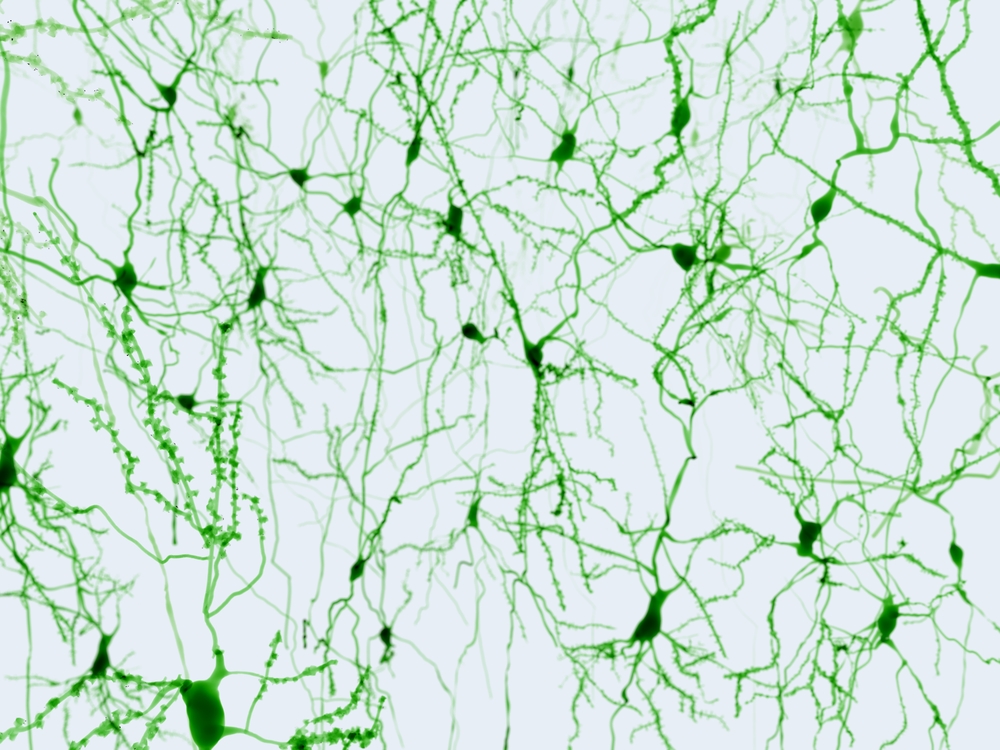 MS and neurons