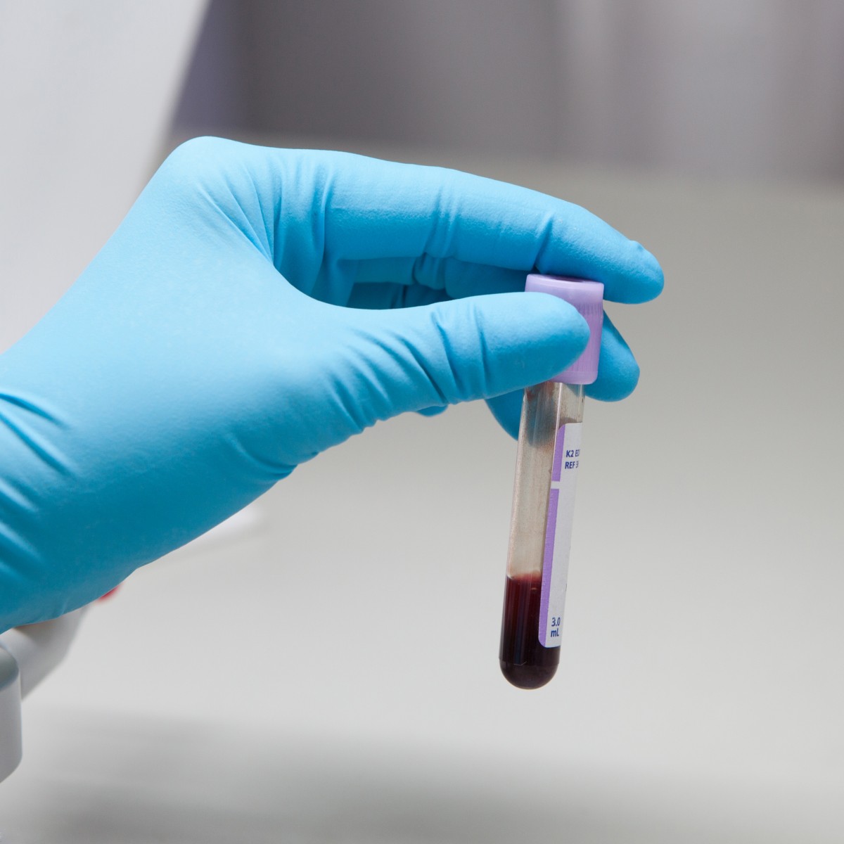 diagnostic RRMS blood test