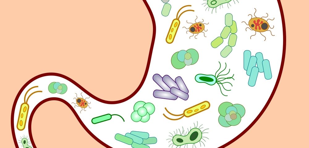 Gut Microbiota in Young MS Patients Is Higher in Pro Gut Microbiota in Young MS Patients Is Higher in Pro
