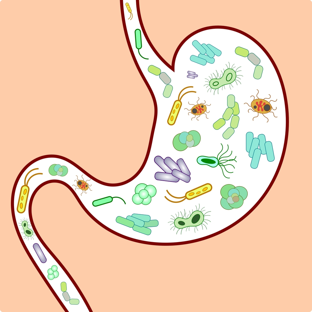 gut microbiota and MS