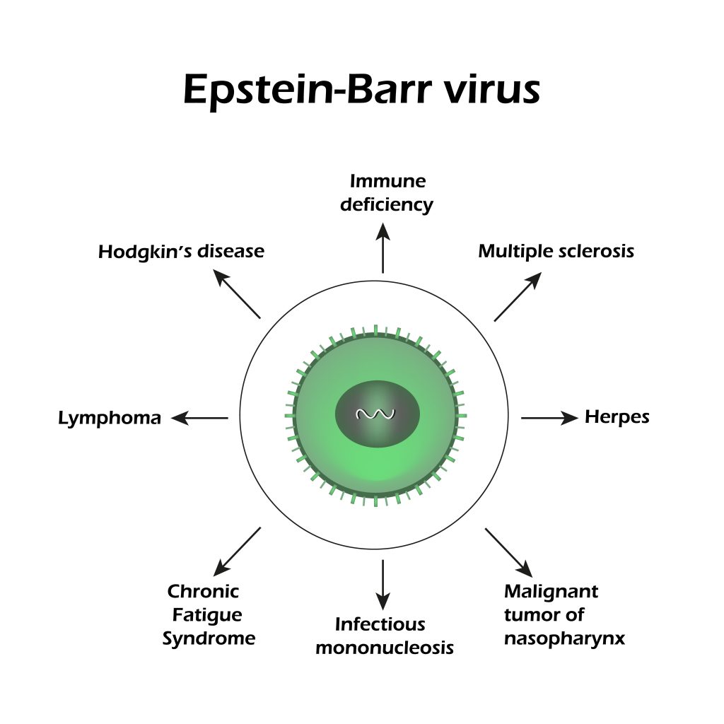 Epstein Barr Virus Symptoms In Toddlers