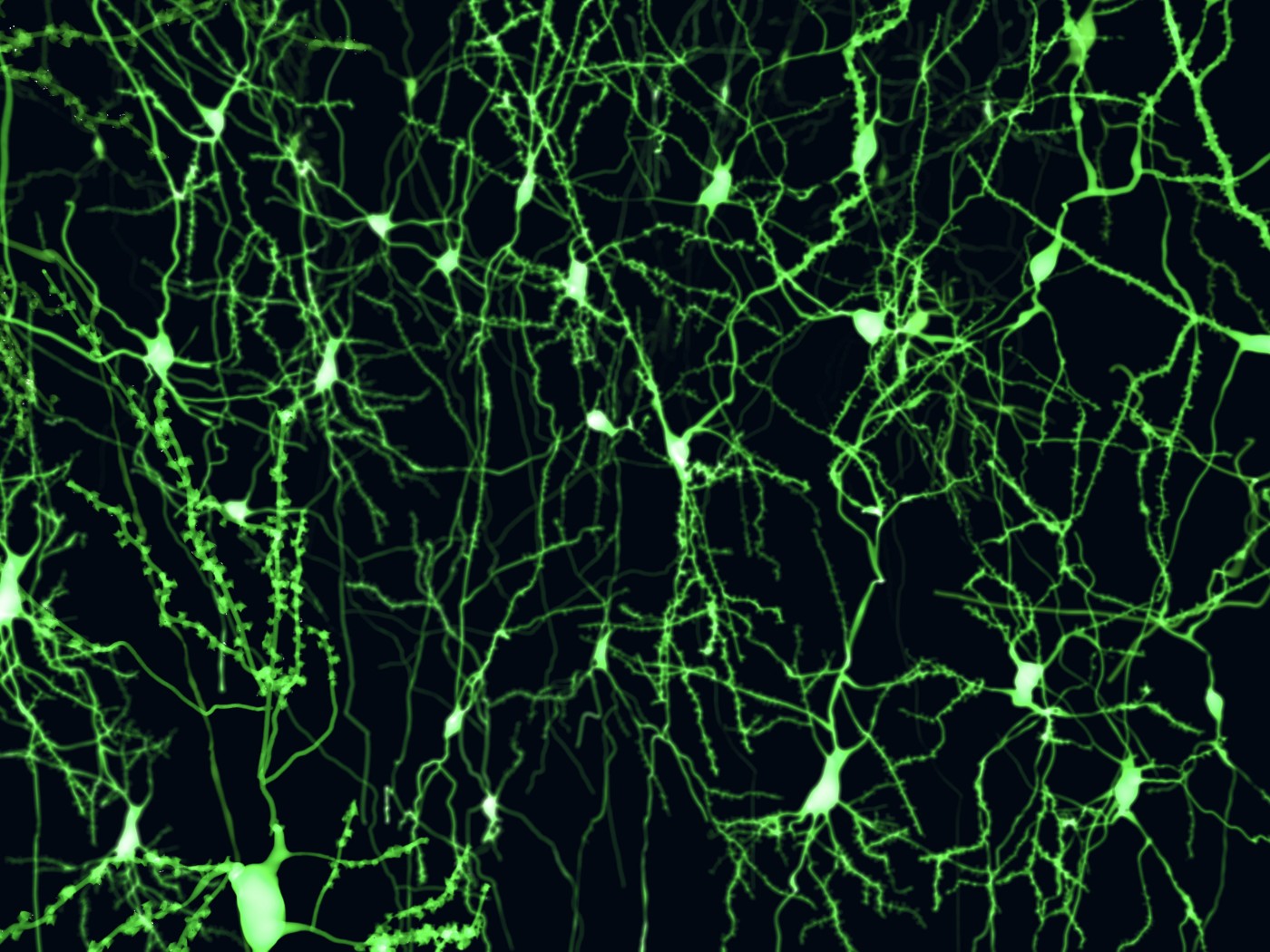 neurons and MS