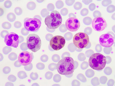 infection fighting cells