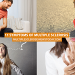 Primary Progressive Multiple Sclerosis (PPMS) - Multiple Sclerosis News ...