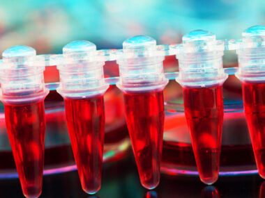 Raxone (idebenone) for PPMS