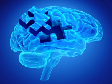 mystery, donating brains