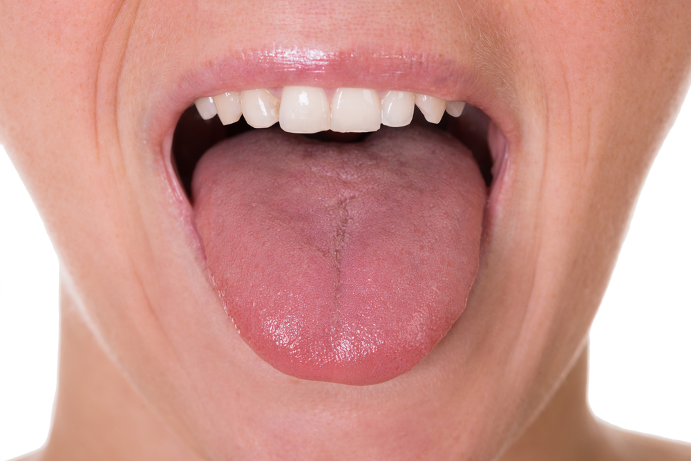 MS tongue stimulation