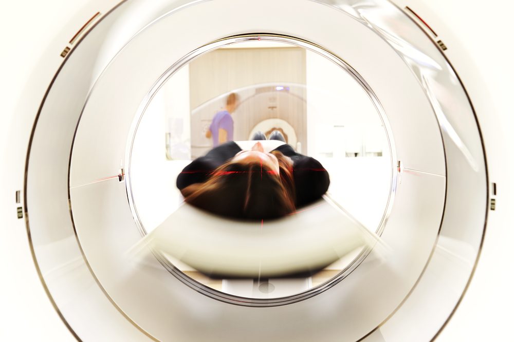 DIAZEPAM DOSE FOR MRI CLAUSTROPHOBIA
