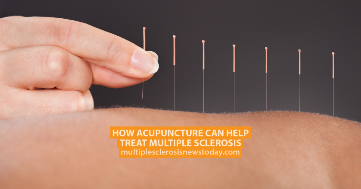 How Acupuncture Can Help Treat Multiple Sclerosis Multiple Sclerosis