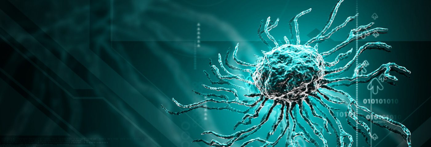 Multiple sclerosis cases in us picture