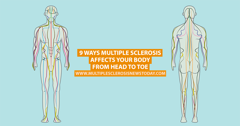 9 Ways Multiple Sclerosis Affects Your Body From Head To Toe Multiple Sclerosis News Today