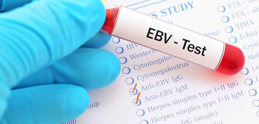 Epstein-Barr Virus Found in Brain Cells of Many MS Patients, Study Reports Epstein-Barr Virus Found in Brain Cells of Many MS Patients, Study Reports