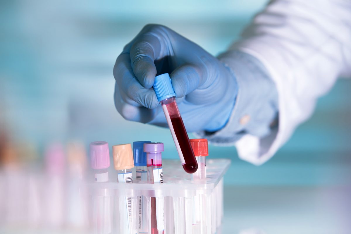 Blood MS Blood Test That Helps Predict Disease Activity Might Lower ...