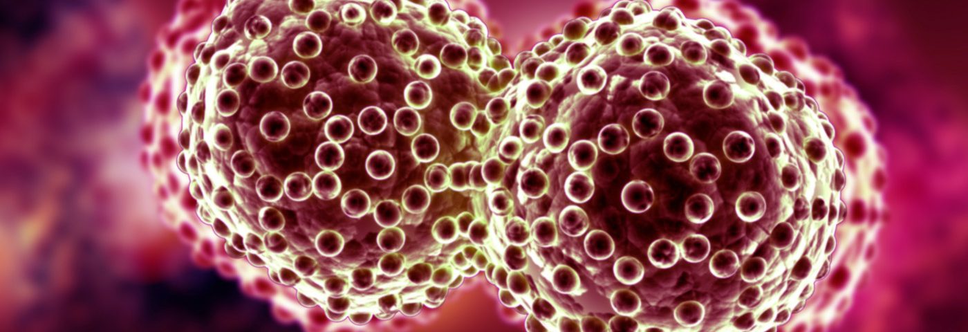 Lifetime Cancer Risk Lower in MS Patients Than General Public, Study Reports Lifetime Cancer Risk Lower in MS Patients Than General Public, Study Reports