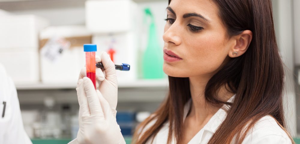 MS Patients’ High Osteopontin Protein Levels Make It a Potential Biomarker for the Disorder, Study Reports MS Patients’ High Osteopontin Protein Levels Make It a Potential Biomarker for the Disorder, Study Reports