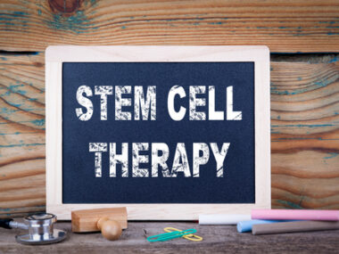stem cells in SPMS
