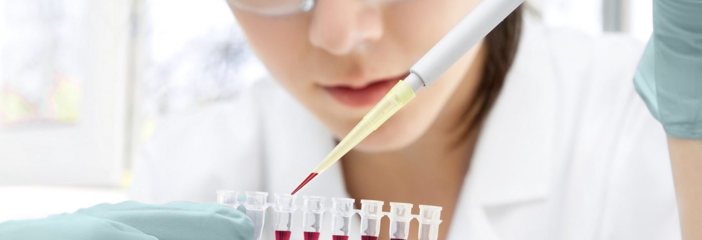 Neurofilament Light Chain Levels in Blood of Value as Biomarker of MS Activity and Treatment Response, Study Finds Neurofilament Light Chain Levels in Blood of Value as Biomarker of MS Activity and Treatment Response, Study Finds