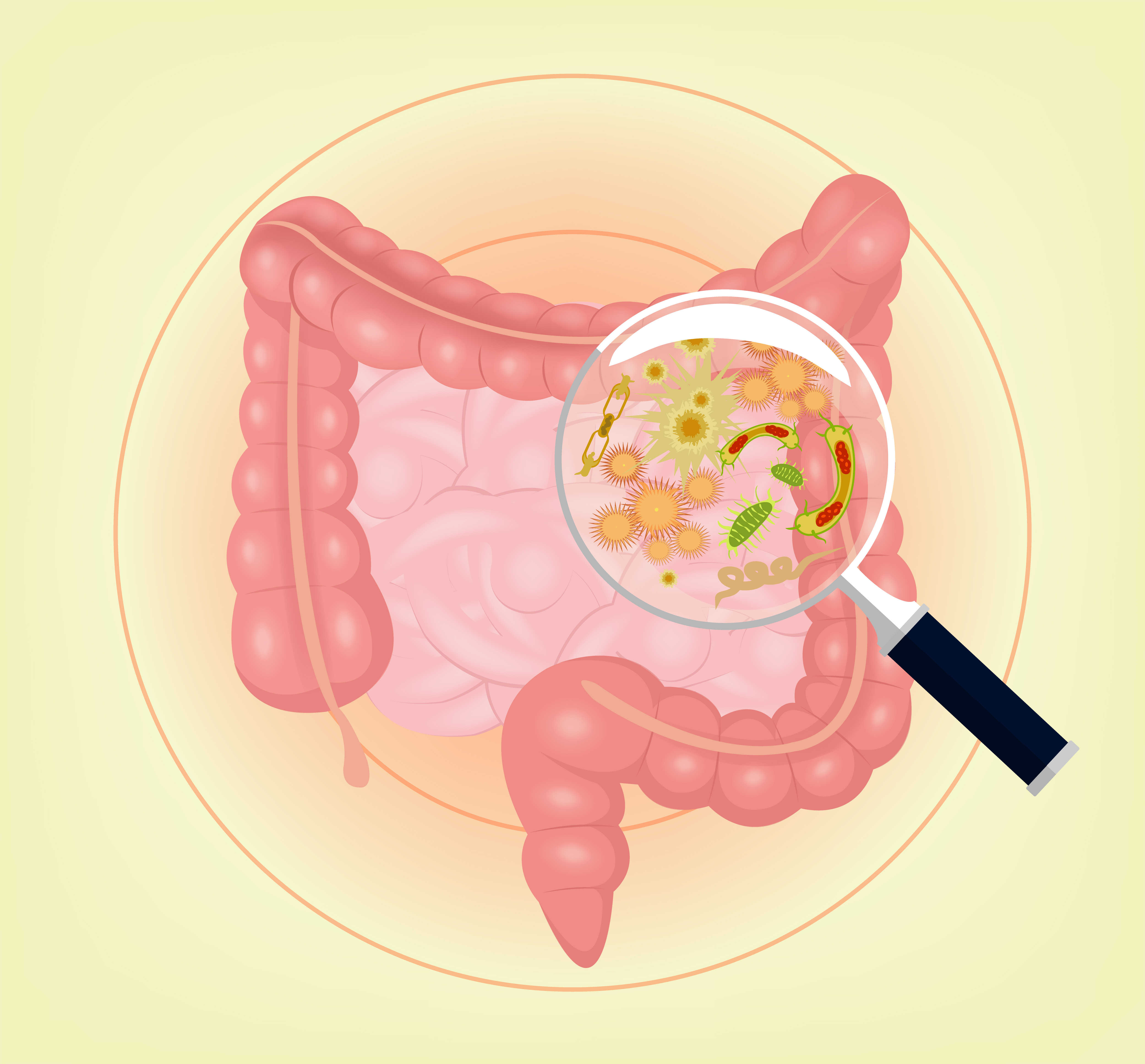 AANAM — Gut Bacteria May Play Role in Pediatric MS, Studies Suggest