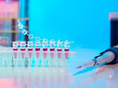cxcl13 as MS biomarker