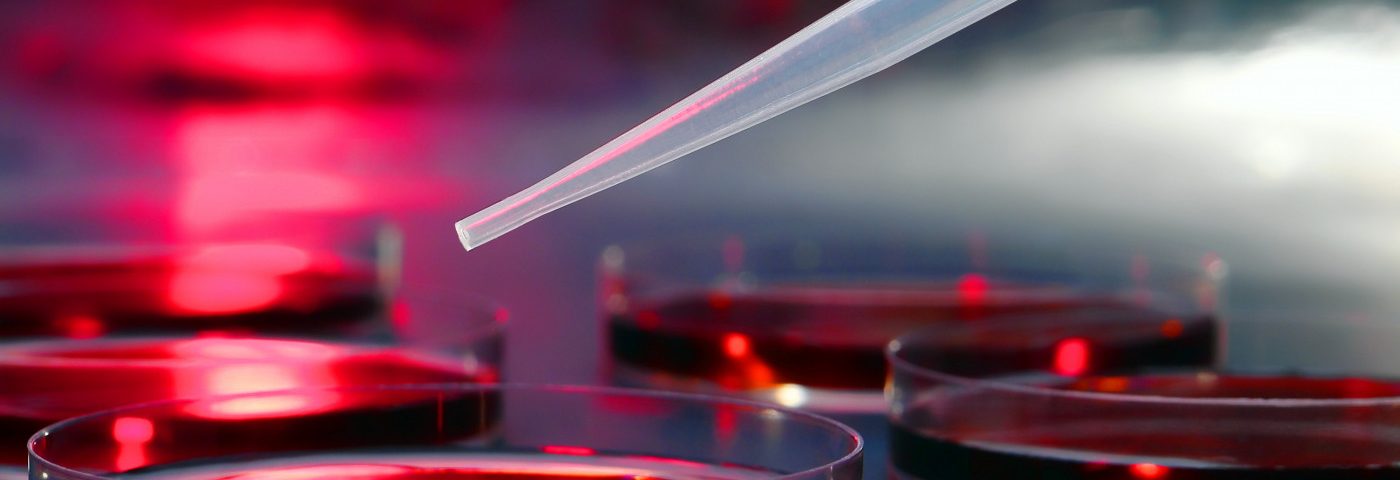 Protein That Helps Cells Break Down Sugar Also Promotes Inflammation, Study Suggests Protein That Helps Cells Break Down Sugar Also Promotes Inflammation, Study Suggests