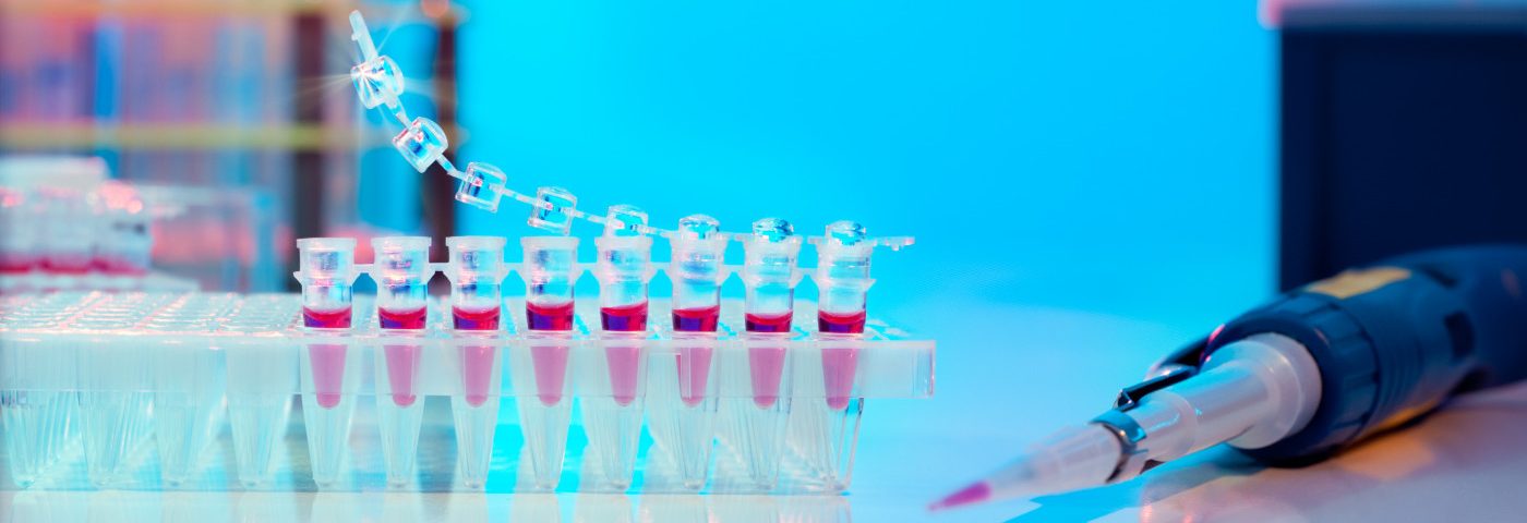 Interleukin-22 May Be Biomarker to Monitor How Well RRMS Patients Respond to Therapy Interleukin-22 May Be Biomarker to Monitor How Well RRMS Patients Respond to Therapy