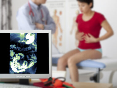 GI symptoms and Vumerity