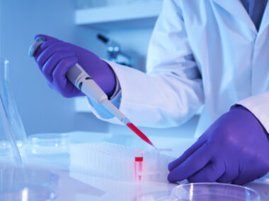 NfL blood levels and disability