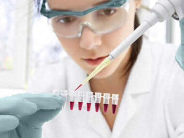 yeast cells and inflammation