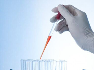 Neurofilament light study