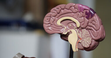 A large plastic model of the brain highlights different regions.