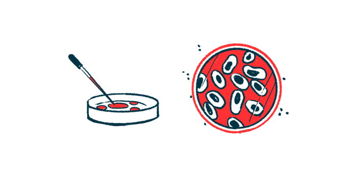 pro-inflammatory Th17 immune cells/Multiple Sclerosis News Today/cells in a petri dish illustration