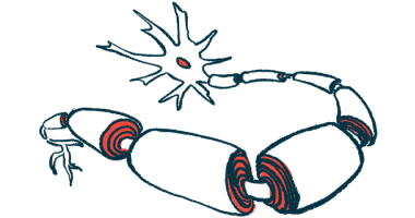 An illustration of neurons covered by the myelin sheath.