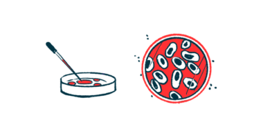 An illustration of a petri dish from two views.