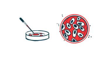 An illustration of a petri dish from two views.