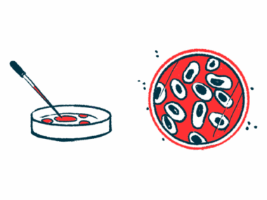 An illustration of a petri dish from two views.
