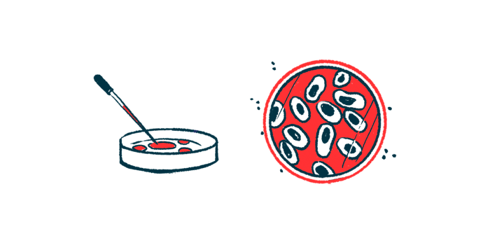 An illustration of a petri dish from two views.