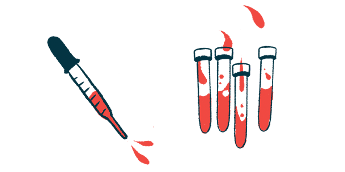 A squirting dropper is shown next to several vials of blood.