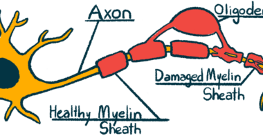 A labeled illustration of a nerve cell, or neuron, and its parts.