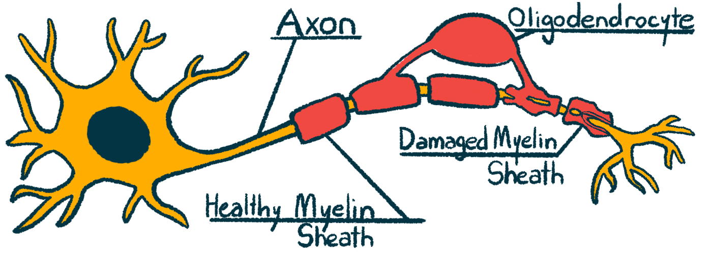 A labeled illustration of a nerve cell, or neuron, and its parts.