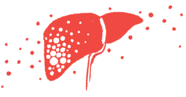 methylprednisolone liver | Multiple Sclerosis News Today | illustration of person's liver