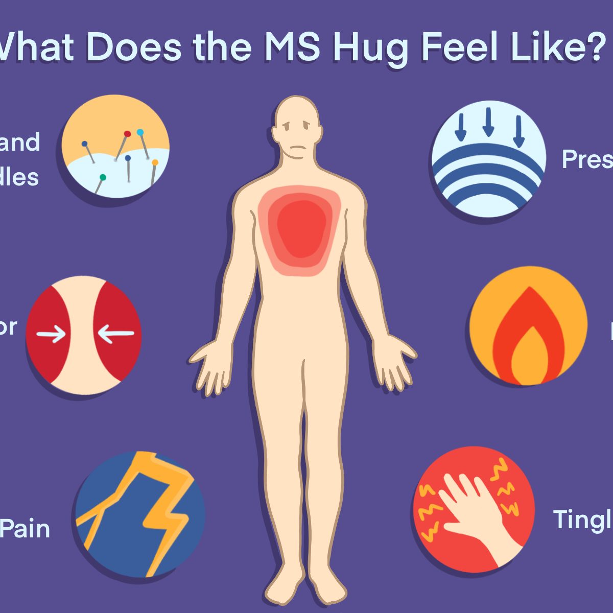 The MS hug: Symptoms, triggers, treatments, and tips to manage